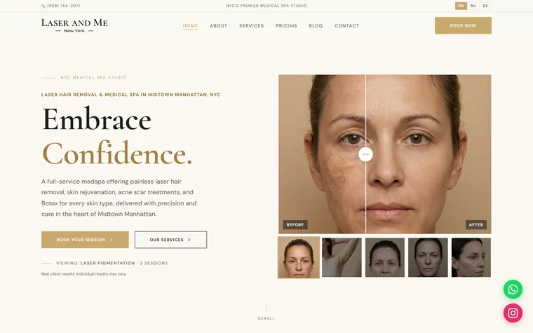 Laserandme homepage